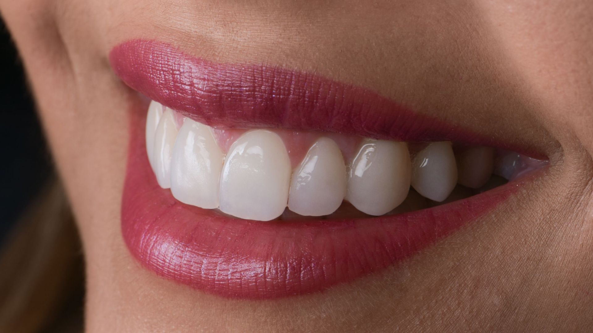 Porcelain veneers cosmetic smile close-up